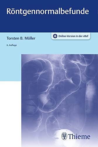 buchcover-roentgennormalbefunde Buchcover Röntgennormalbefunde (6. Auflage)