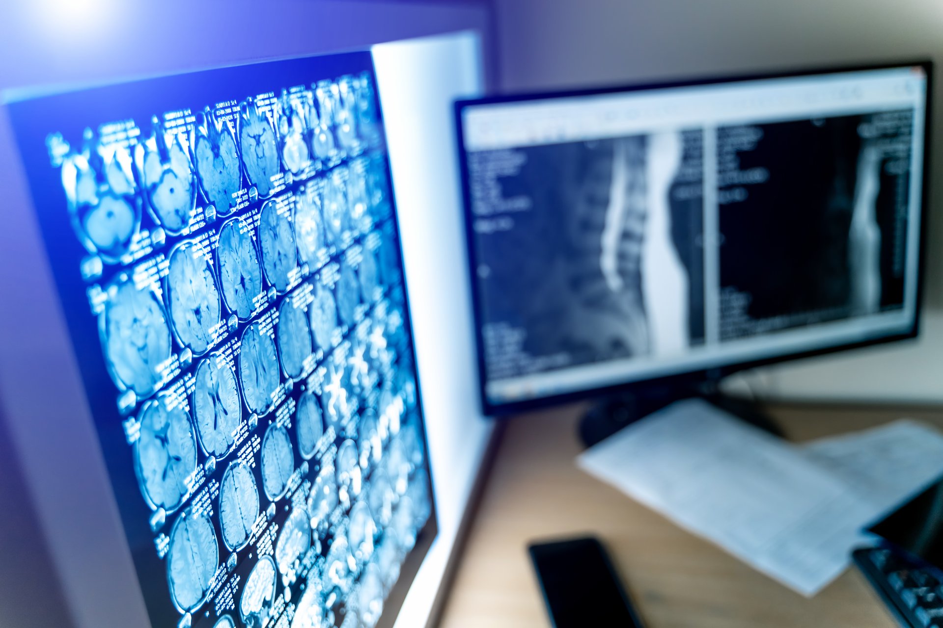 medical-ct-mri-pet-scan-film-computer-monitor-technologically-advanced-functional-medical-office