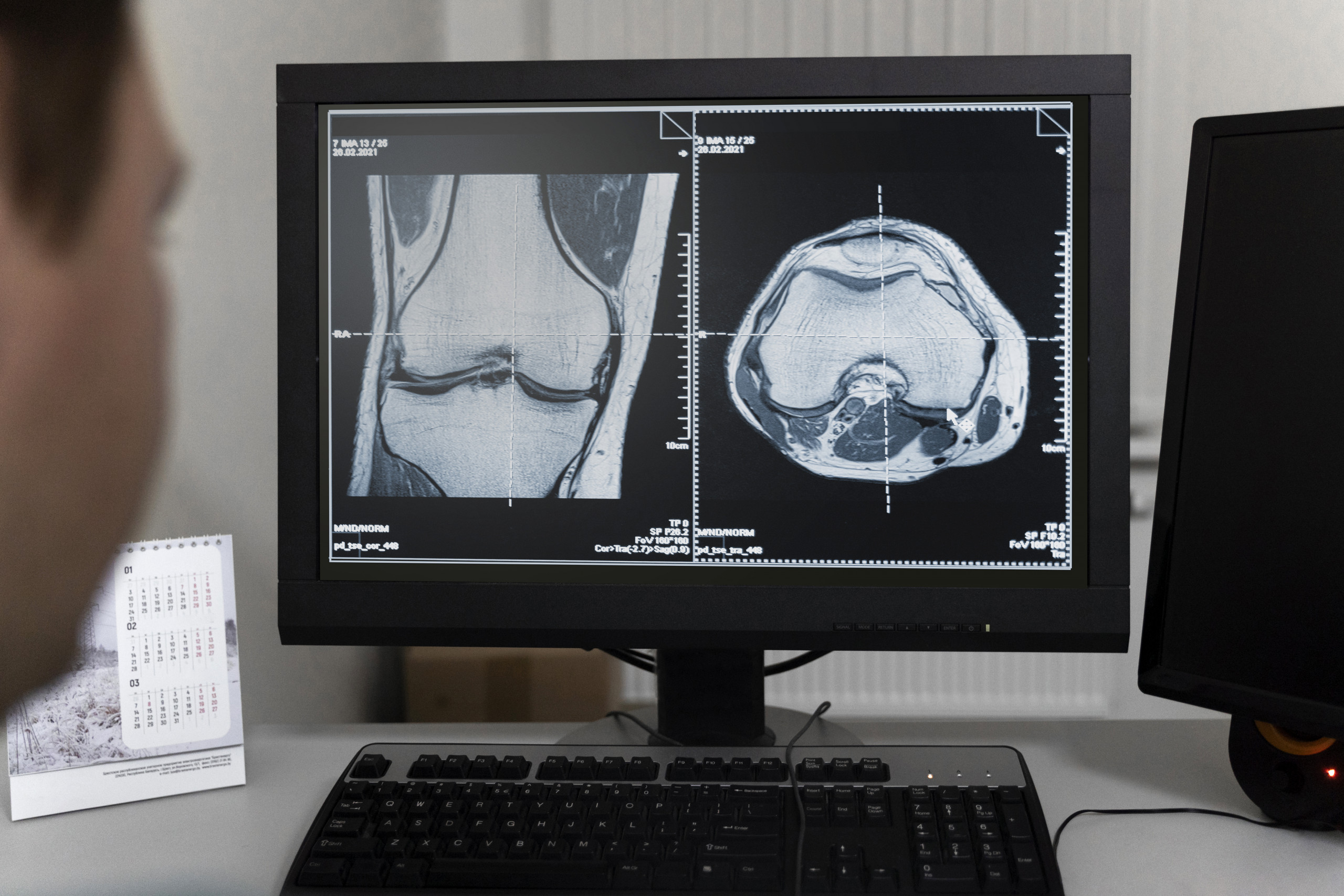 doctor-looking-ct-scans-computer doctor-looking-ct-scans-computer