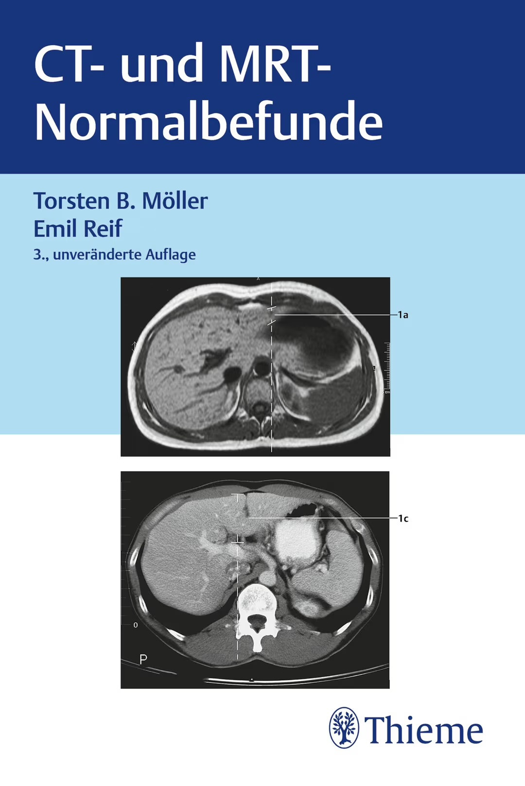 buchcover-ct-mrt-normalbefunde Buchcover CT und MRT Normalbefunde (3. Auflage)