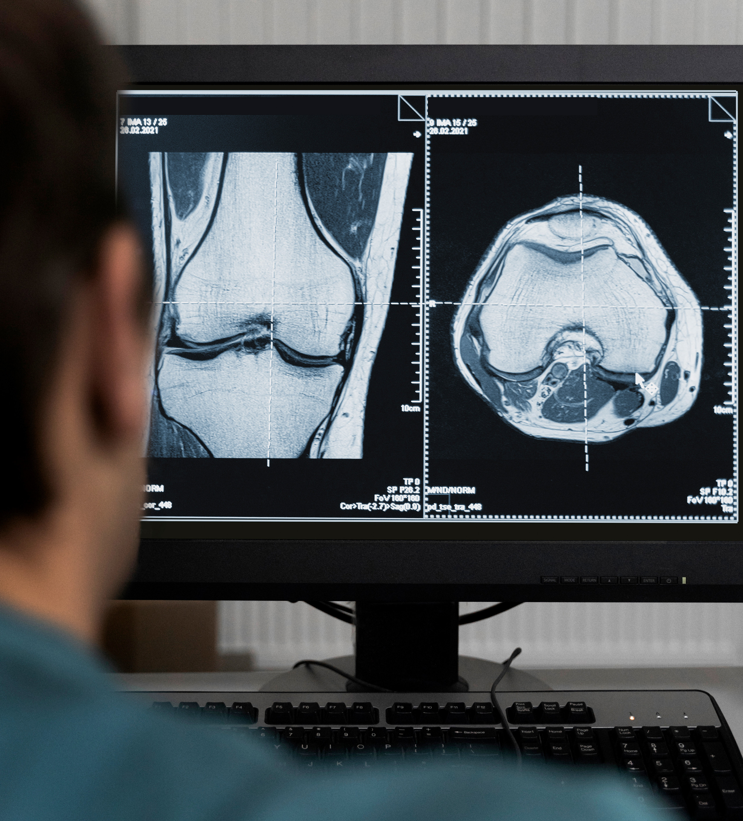 Radiologe betrachtet MRT-Aufnahmen am Monitor – digitale Befundung über RIS-Systeme in der Teleradiologie Radiologe analysiert CT- und MRT-Bilder am Monitor im integrierten Radiologieinformationssystem (RIS)