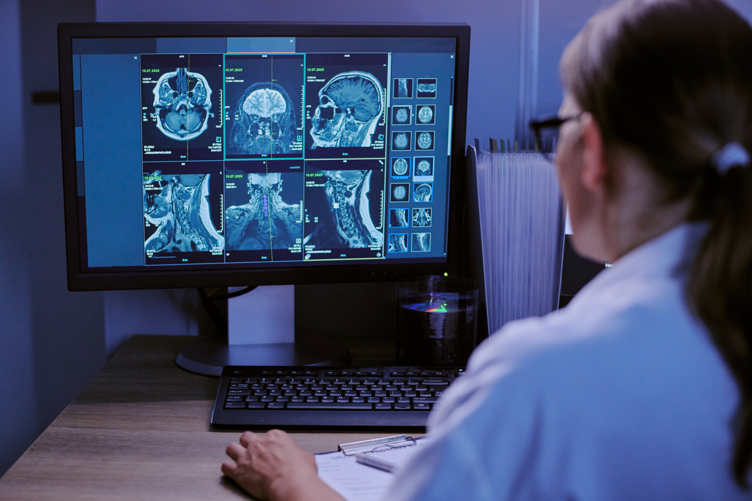 caucasian-female-doctor-analyzing-brain-spine-mri-scans-computer-monitor